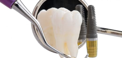 Hirurgija implantant