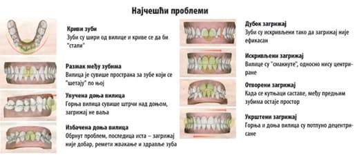 Najčešći problemi ortodoncije